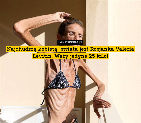 Najchudszą kobietą  świata jest Rosjanka Valeria Levitin. Waży jedyne 25 kilo! 