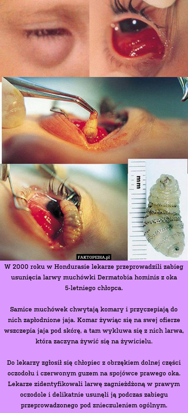 W 2000 roku w Hondurasie lekarze przeprowadzili zabieg usunięcia larwy muchówki Dermatobia hominis z oka 5-letniego chłopca.

Samice muchówek chwytają komary i przyczepiają do nich zapłodnione jaja. Komar żywiąc się na swej ofierze wszczepia jaja pod skórę, a tam wykluwa się z nich larwa, która zaczyna żywić się na żywicielu.

Do lekarzy zgłosił się chłopiec z obrzękiem dolnej części oczodołu i czerwonym guzem na spojówce prawego oka. Lekarze zidentyfikowali larwę zagnieżdżoną w prawym oczodole i delikatnie usunęli ją podczas zabiegu przeprowadzonego pod znieczuleniem ogólnym. 