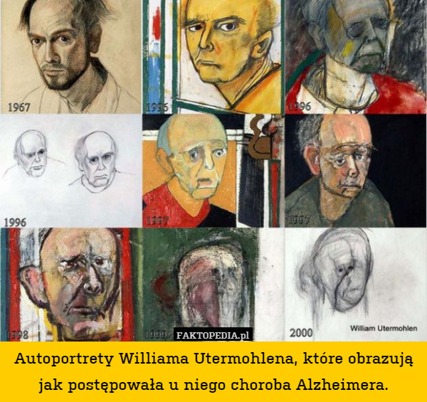 Autoportrety Williama Utermohlena, które obrazują jak postępowała u niego choroba Alzheimera. 