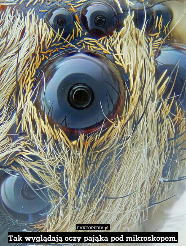 Tak wyglądają oczy pająka pod mikroskopem. 