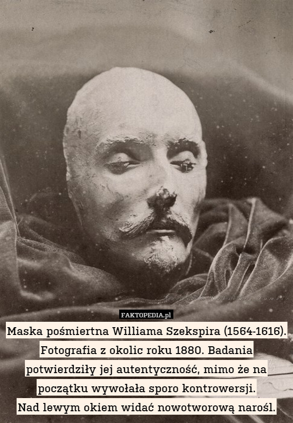 Maska pośmiertna Williama Szekspira (1564-1616). Fotografia z okolic roku 1880. Badania potwierdziły jej autentyczność, mimo że na początku wywołała sporo kontrowersji.
Nad lewym okiem widać nowotworową narośl. 