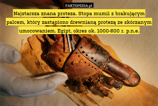 Najstarsza znana proteza. Stopa mumii z brakującym palcem, który zastąpiono drewnianą protezą ze skórzanym umocowaniem. Egipt, okres ok. 1000-600 r. p.n.e. 