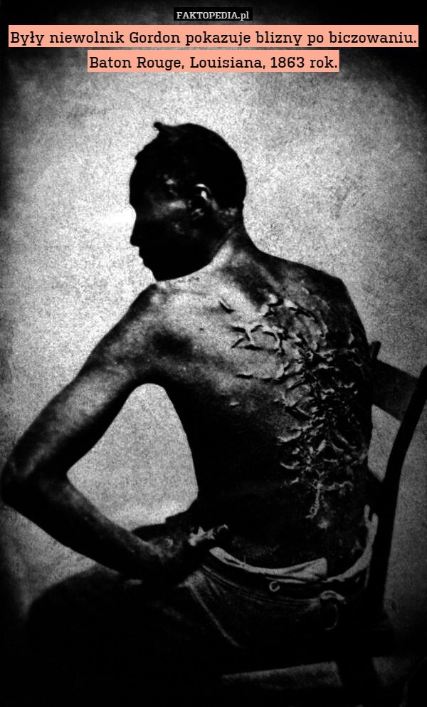 Były niewolnik Gordon pokazuje blizny po biczowaniu.
Baton Rouge, Louisiana, 1863 rok. 