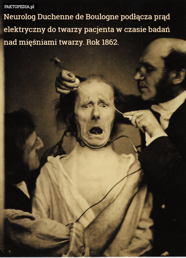 Neurolog Duchenne de Boulogne podłącza prąd elektryczny do twarzy pacjenta w czasie badań nad mięśniami twarzy. Rok 1862. 