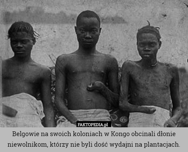 Belgowie na swoich koloniach w Kongo obcinali dłonie niewolnikom, którzy nie byli dość wydajni na plantacjach. 