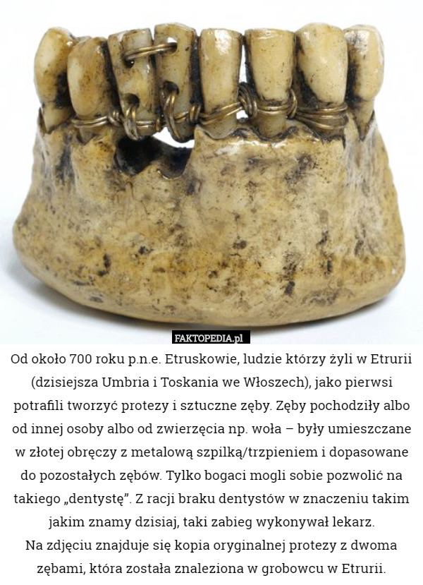 Od około 700 roku p.n.e. Etruskowie, ludzie którzy żyli w Etrurii (dzisiejsza Umbria i Toskania we Włoszech), jako pierwsi potrafili tworzyć protezy i sztuczne zęby. Zęby pochodziły albo od innej osoby albo od zwierzęcia np. woła – były umieszczane w złotej obręczy z metalową szpilką/trzpieniem i dopasowane do pozostałych zębów. Tylko bogaci mogli sobie pozwolić na takiego „dentystę”. Z racji braku dentystów w znaczeniu takim jakim znamy dzisiaj, taki zabieg wykonywał lekarz.
 Na zdjęciu znajduje się kopia oryginalnej protezy z dwoma zębami, która została znaleziona w grobowcu w Etrurii. 