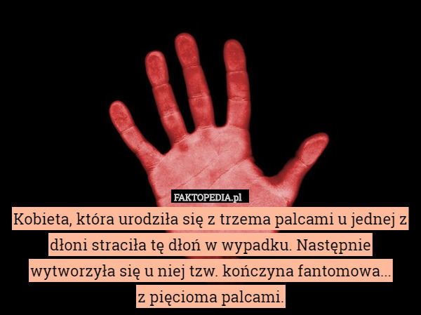 Kobieta, która urodziła się z trzema palcami u jednej z dłoni straciła tę dłoń w wypadku. Następnie wytworzyła się u niej tzw. kończyna fantomowa...
z pięcioma palcami. 