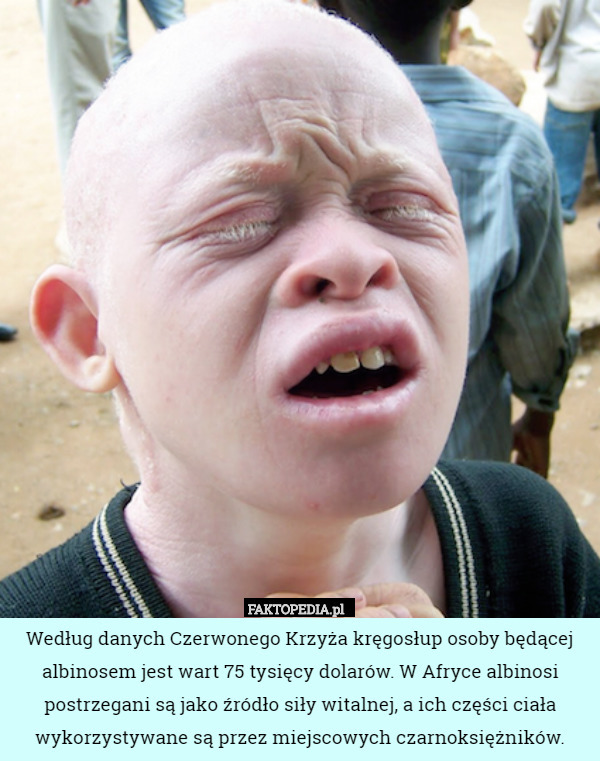 Według danych Czerwonego Krzyża kręgosłup osoby będącej albinosem jest wart 75 tysięcy dolarów. W Afryce albinosi postrzegani są jako źródło siły witalnej, a ich części ciała wykorzystywane są przez miejscowych czarnoksiężników. 