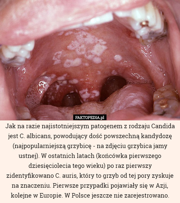 Jak na razie najistotniejszym patogenem z rodzaju Candida jest C. albicans, powodujący dość powszechną kandydozę (najpopularniejszą grzybicę - na zdjęciu grzybica jamy ustnej). W ostatnich latach (końcówka pierwszego dziesięciolecia tego wieku) po raz pierwszy zidentyfikowano C. auris, który to grzyb od tej pory zyskuje na znaczeniu. Pierwsze przypadki pojawiały się w Azji, kolejne w Europie. W Polsce jeszcze nie zarejestrowano. 
