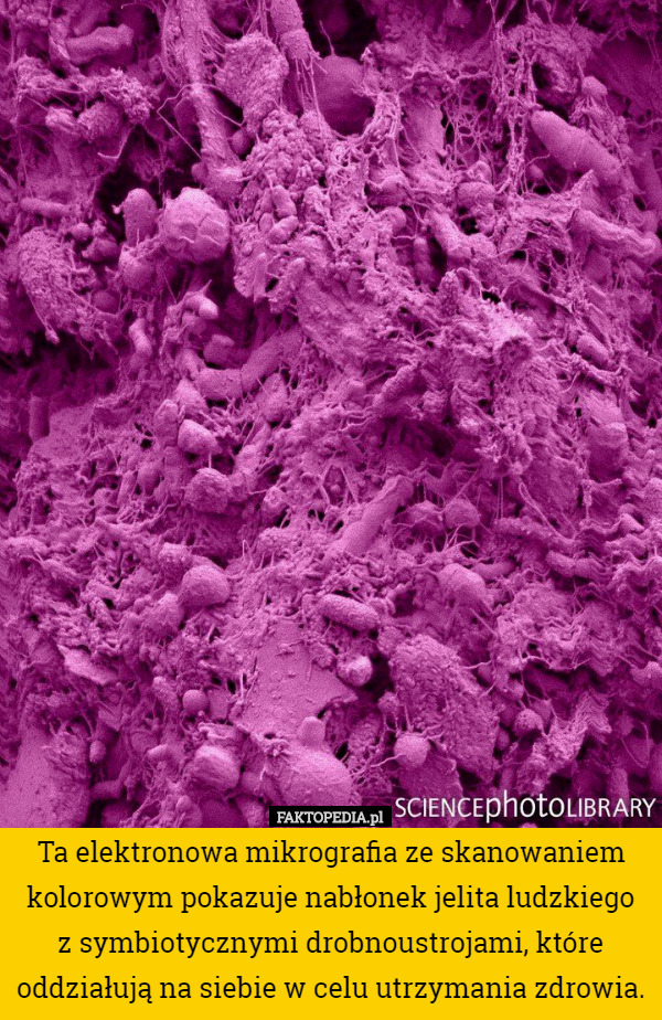 Ta elektronowa mikrografia ze skanowaniem kolorowym pokazuje nabłonek jelita ludzkiego z symbiotycznymi drobnoustrojami, które oddziałują na siebie w celu utrzymania zdrowia. 