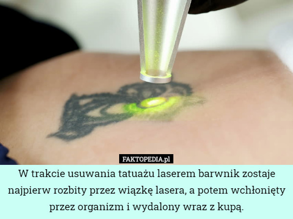 W trakcie usuwania tatuażu laserem barwnik zostaje najpierw rozbity przez wiązkę lasera, a potem wchłonięty przez organizm i wydalony wraz z kupą. 