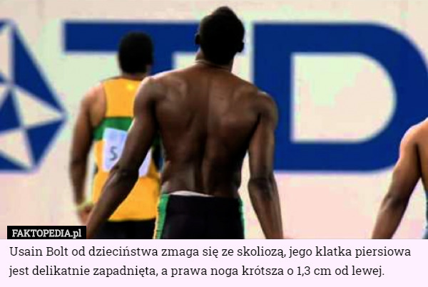 Usain Bolt od dzieciństwa zmaga się ze skoliozą, jego klatka piersiowa jest delikatnie zapadnięta, a prawa noga krótsza o 1,3 cm od lewej. 