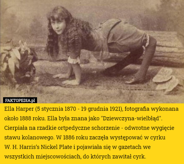 Ella Harper (5 stycznia 1870 - 19 grudnia 1921), fotografia wykonana około 1888 roku. Ella była znana jako "Dziewczyna-wielbłąd". Cierpiała na rzadkie ortpedyczne schorzenie - odwrotne wygięcie stawu kolanowego. W 1886 roku zaczęła występować w cyrku
 W. H. Harris’s Nickel Plate i pojawiała się w gazetach we wszystkich miejscowościach, do których zawitał cyrk. 