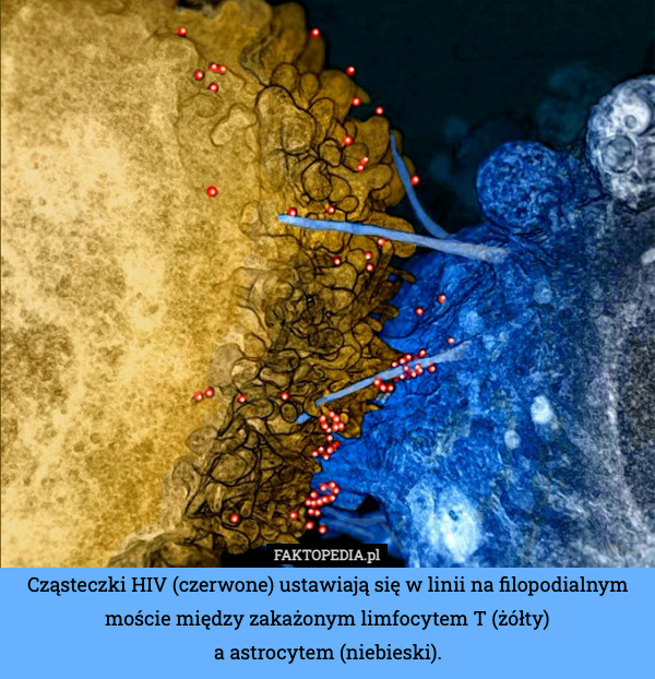 Cząsteczki HIV (czerwone) ustawiają się w linii na filopodialnym moście między zakażonym limfocytem T (żółty)
a astrocytem (niebieski). 