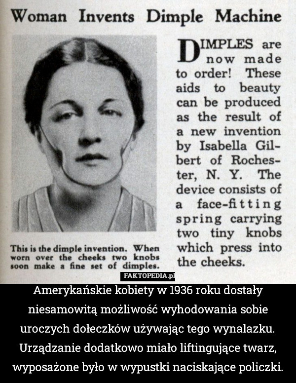 Amerykańskie kobiety w 1936 roku dostały niesamowitą możliwość wyhodowania sobie uroczych dołeczków używając tego wynalazku. Urządzanie dodatkowo miało liftingujące twarz, wyposażone było w wypustki naciskające policzki. 