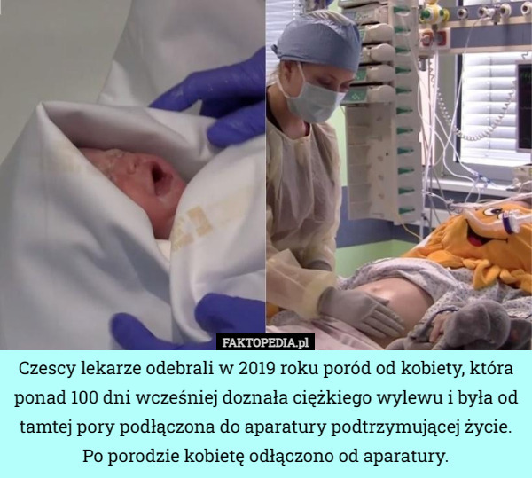 Czescy lekarze odebrali w 2019 roku poród od kobiety, która ponad 100 dni wcześniej doznała ciężkiego wylewu i była od tamtej pory podłączona do aparatury podtrzymującej życie. Po porodzie kobietę odłączono od aparatury. 