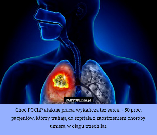 Choć POChP atakuje płuca, wykańcza też serce. - 50 proc. pacjentów, którzy trafiają do szpitala z zaostrzeniem choroby umiera w ciągu trzech lat. 