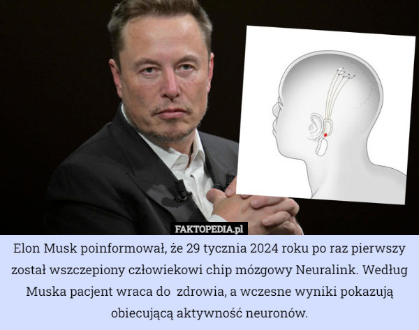 Elon Musk poinformował, że 29 tycznia 2024 roku po raz pierwszy został wszczepiony człowiekowi chip mózgowy Neuralink. Według Muska pacjent wraca do  zdrowia, a wczesne wyniki pokazują obiecującą aktywność neuronów. 