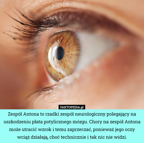 Zespół Antona to rzadki zespół neurologiczny polegający na uszkodzeniu płata potylicznego mózgu. Chory na zespół Antona może utracić wzrok i temu zaprzeczać, ponieważ jego oczy wciąż działają, choć technicznie i tak nic nie widzi. 