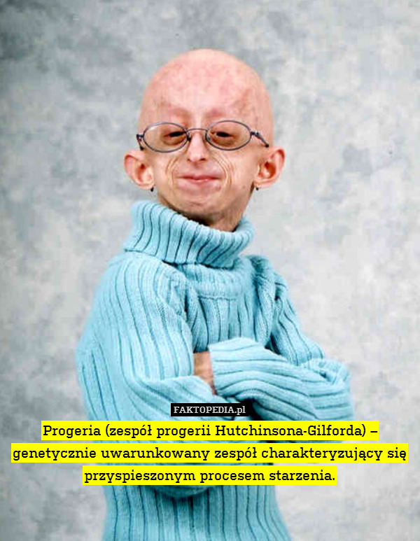 Progeria (zespół progerii Hutchinsona-Gilforda) – genetycznie uwarunkowany zespół charakteryzujący się przyspieszonym procesem starzenia. 