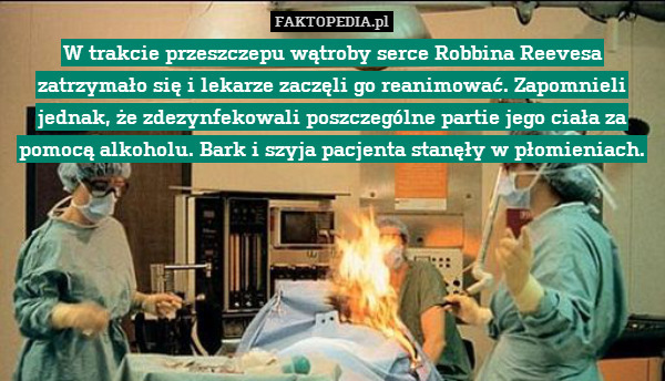 W trakcie przeszczepu wątroby serce Robbina Reevesa zatrzymało się i lekarze zaczęli go reanimować. Zapomnieli jednak, że zdezynfekowali poszczególne partie jego ciała za pomocą alkoholu. Bark i szyja pacjenta stanęły w płomieniach. 