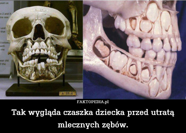 Tak wygląda czaszka dziecka przed utratą mlecznych zębów. 