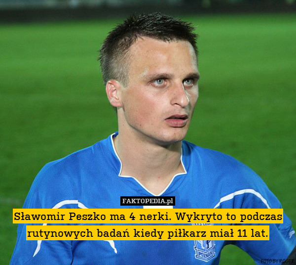 Sławomir Peszko ma 4 nerki. Wykryto to podczas rutynowych badań kiedy piłkarz miał 11 lat. 