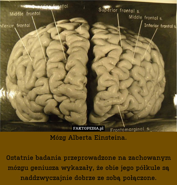 Mózg Alberta Einsteina.

Ostatnie badania przeprowadzone na zachowanym mózgu geniusza wykazały, że obie jego półkule są naddzwyczajnie dobrze ze sobą połączone. 