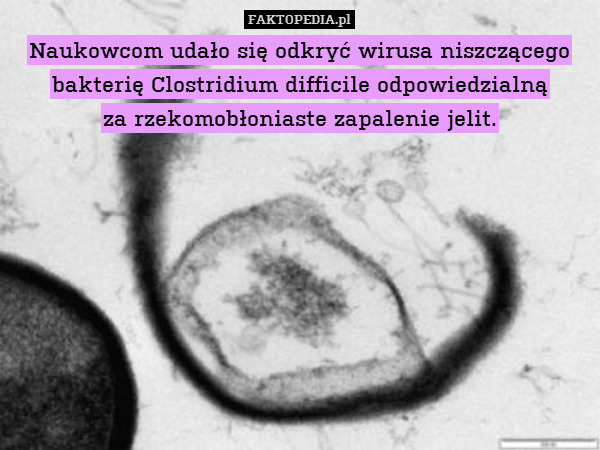 Naukowcom udało się odkryć wirusa niszczącego bakterię Clostridium difficile odpowiedzialną
za rzekomobłoniaste zapalenie jelit. 
