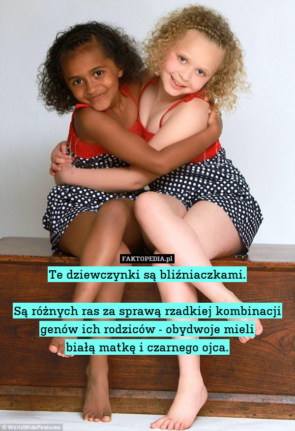Te dziewczynki są bliźniaczkami.

Są różnych ras za sprawą rzadkiej kombinacji genów ich rodziców - obydwoje mieli
białą matkę i czarnego ojca. 