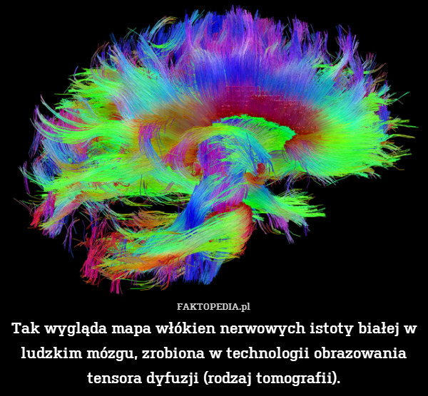 Tak wygląda mapa włókien nerwowych istoty białej w ludzkim mózgu, zrobiona w technologii obrazowania tensora dyfuzji (rodzaj tomografii). 