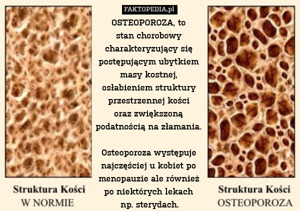 osteoporoza to