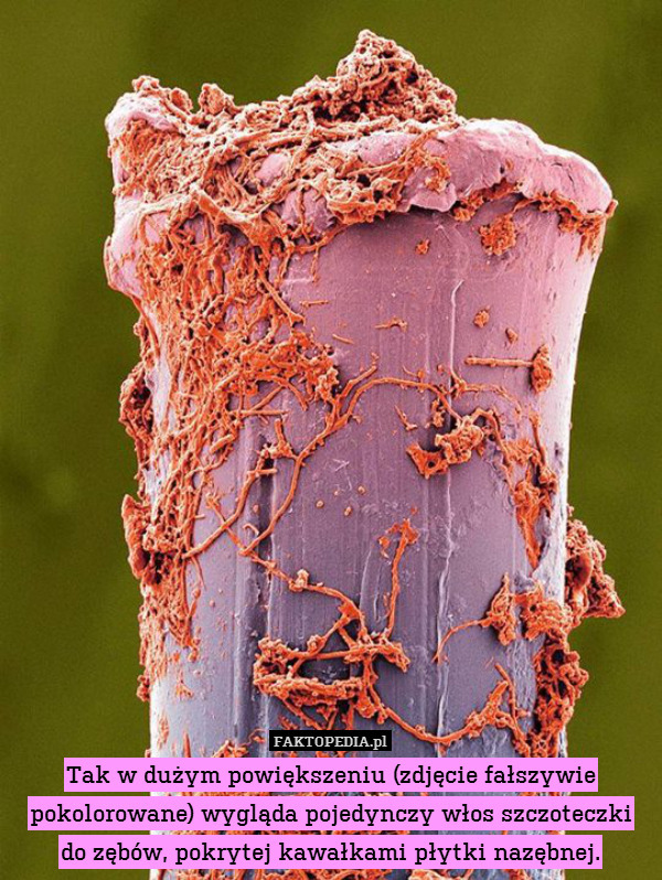 Tak w dużym powiększeniu (zdjęcie fałszywie pokolorowane) wygląda pojedynczy włos szczoteczki
do zębów, pokrytej kawałkami płytki nazębnej. 