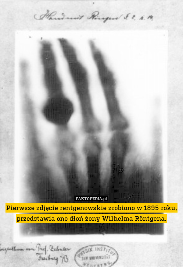 Pierwsze zdjęcie rentgenowskie zrobiono w 1895 roku, przedstawia ono dłoń żony Wilhelma Röntgena. 