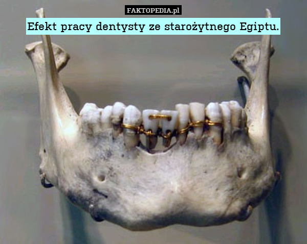 Efekt pracy dentysty ze starożytnego Egiptu. 