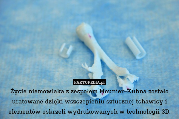 Życie niemowlaka z zespołem Mounier–Kuhna zostało uratowane dzięki wszczepieniu sztucznej tchawicy i elementów oskrzeli wydrukowanych w technologii 3D. 