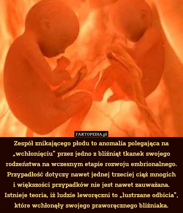 Zespół znikającego płodu to anomalia polegająca na „wchłonięciu” przez jedno z bliźniąt tkanek swojego rodzeństwa na wczesnym etapie rozwoju embrionalnego. Przypadłość dotyczy nawet jednej trzeciej ciąż mnogich
i większości przypadków nie jest nawet zauważana. Istnieje teoria, iż ludzie leworęczni to „lustrzane odbicia”, które wchłonęły swojego praworęcznego bliźniaka. 