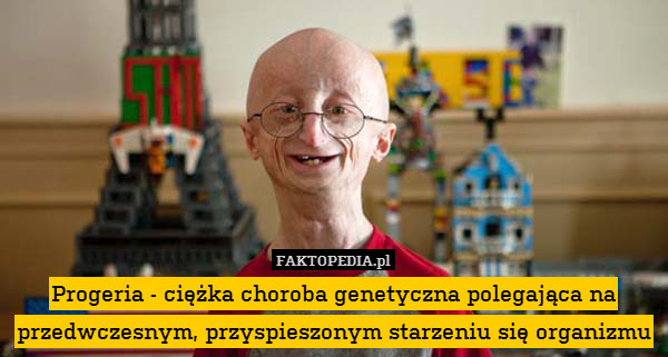 Progeria - ciężka choroba genetyczna polegająca na przedwczesnym, przyspieszonym starzeniu się organizmu 