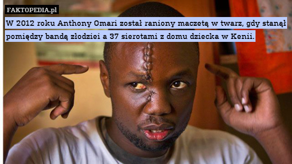 W 2012 roku Anthony Omari został raniony maczetą w twarz, gdy stanął pomiędzy bandą złodziei a 37 sierotami z domu dziecka w Kenii. 