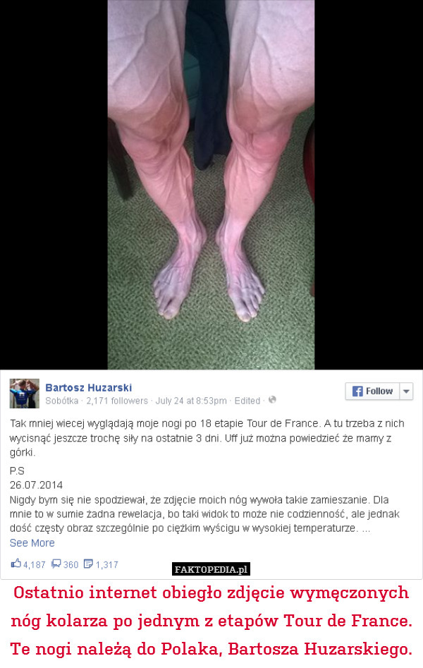 Ostatnio internet obiegło zdjęcie wymęczonych nóg kolarza po jednym z etapów Tour de France. Te nogi należą do Polaka, Bartosza Huzarskiego. 