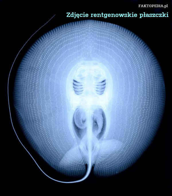 Zdjęcie rentgenowskie płaszczki 