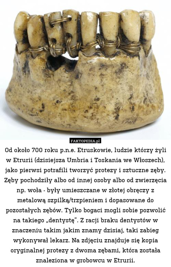 Od około 700 roku p.n.e. Etruskowie, ludzie którzy żyli w Etrurii (dzisiejsza Umbria i Toskania we Włoszech), jako pierwsi potrafili tworzyć protezy i sztuczne zęby. Zęby pochodziły albo od innej osoby albo od zwierzęcia np. woła - były umieszczane w złotej obręczy z metalową szpilką/trzpieniem i dopasowane do pozostałych zębów. Tylko bogaci mogli sobie pozwolić na takiego „dentystę”. Z racji braku dentystów w znaczeniu takim jakim znamy dzisiaj, taki zabieg wykonywał lekarz. Na zdjęciu znajduje się kopia oryginalnej protezy z dwoma zębami, która została znaleziona w grobowcu w Etrurii. 