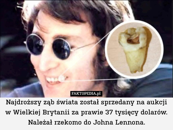 Najdroższy ząb świata został sprzedany na aukcji
w Wielkiej Brytanii za prawie 37 tysięcy dolarów. Należał rzekomo do Johna Lennona. 