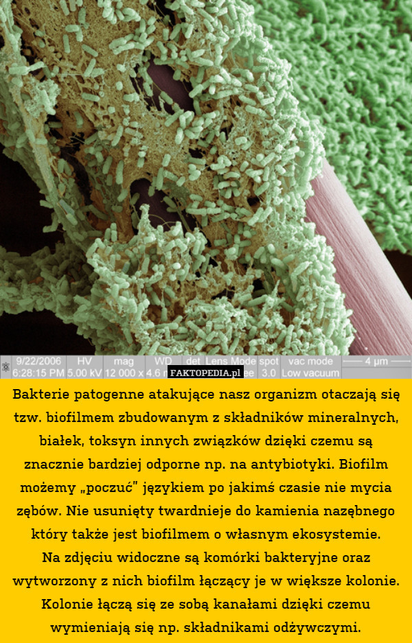 Nasz Organizm Zawiera Okolo 2 5 Kg Tego Pierwiastka Bakterie patogenne atakujące nasz organizm otaczają się tzw. biofilmem zbudowanym