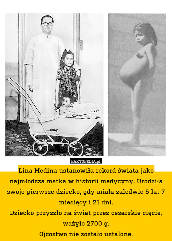 Lina Medina ustanowiła rekord świata jako najmłodsza matka w historii medycyny. Urodziła swoje pierwsze dziecko, gdy miała zaledwie 5 lat 7 miesięcy i 21 dni.
Dziecko przyszło na świat przez cesarskie cięcie, ważyło 2700 g.
Ojcostwo nie zostało ustalone. 
