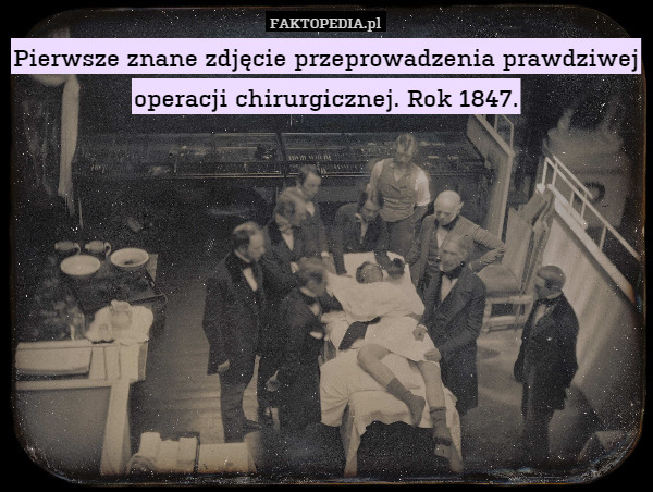 Pierwsze znane zdjęcie przeprowadzenia prawdziwej operacji chirurgicznej. Rok 1847. 
