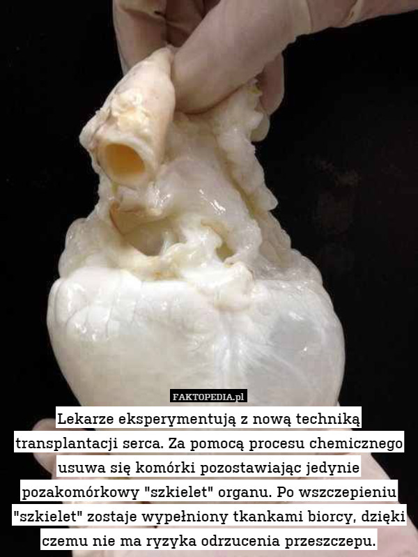 Lekarze eksperymentują z nową techniką transplantacji serca. Za pomocą procesu chemicznego usuwa się komórki pozostawiając jedynie pozakomórkowy "szkielet" organu. Po wszczepieniu "szkielet" zostaje wypełniony tkankami biorcy, dzięki czemu nie ma ryzyka odrzucenia przeszczepu. 