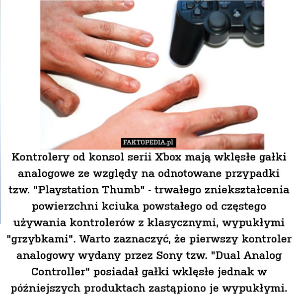 Kontrolery od konsol serii Xbox mają wklęsłe gałki analogowe ze względy na odnotowane przypadki tzw. "Playstation Thumb" - trwałego zniekształcenia powierzchni kciuka powstałego od częstego używania kontrolerów z klasycznymi, wypukłymi "grzybkami". Warto zaznaczyć, że pierwszy kontroler analogowy wydany przez Sony tzw. "Dual Analog Controller" posiadał gałki wklęsłe jednak w późniejszych produktach zastąpiono je wypukłymi. 