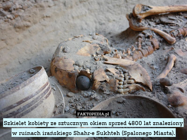 Szkielet kobiety ze sztucznym okiem sprzed 4800 lat znaleziony w ruinach irańskiego Shahr-e Sukhteh (Spalonego Miasta). 