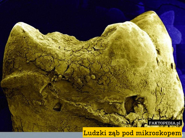 Ludzki ząb pod mikroskopem 